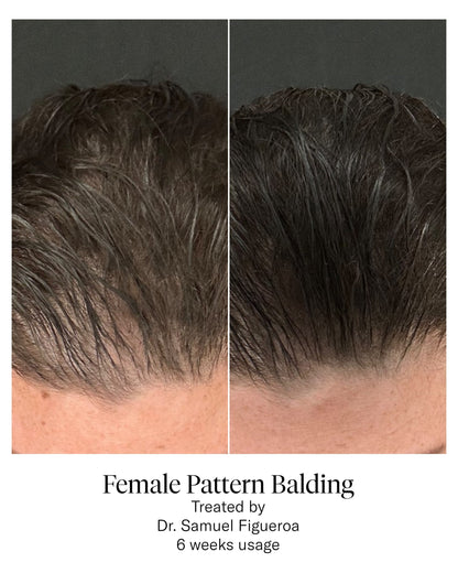Advanced Hair System
